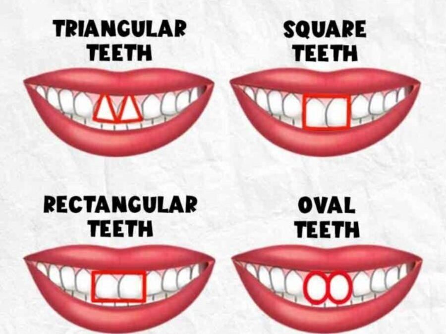 Что форма зубов может сказать о вашем характере: тест на личность