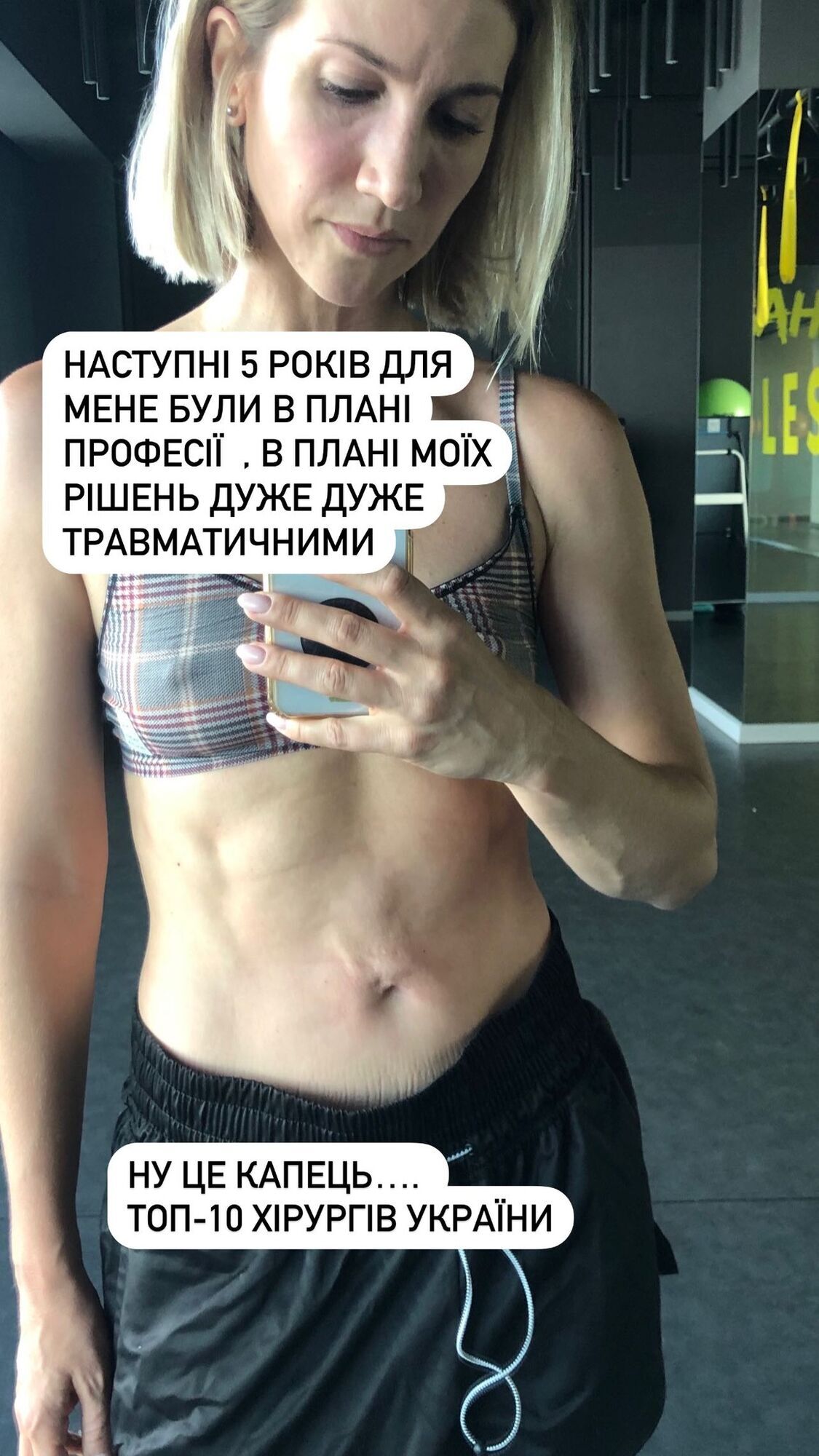 Аніта Луценко вперше показала фото, як її спотворив хірург із топ-10 найкращих України, і пояснила, чому останнім часом приховувала свій живіт