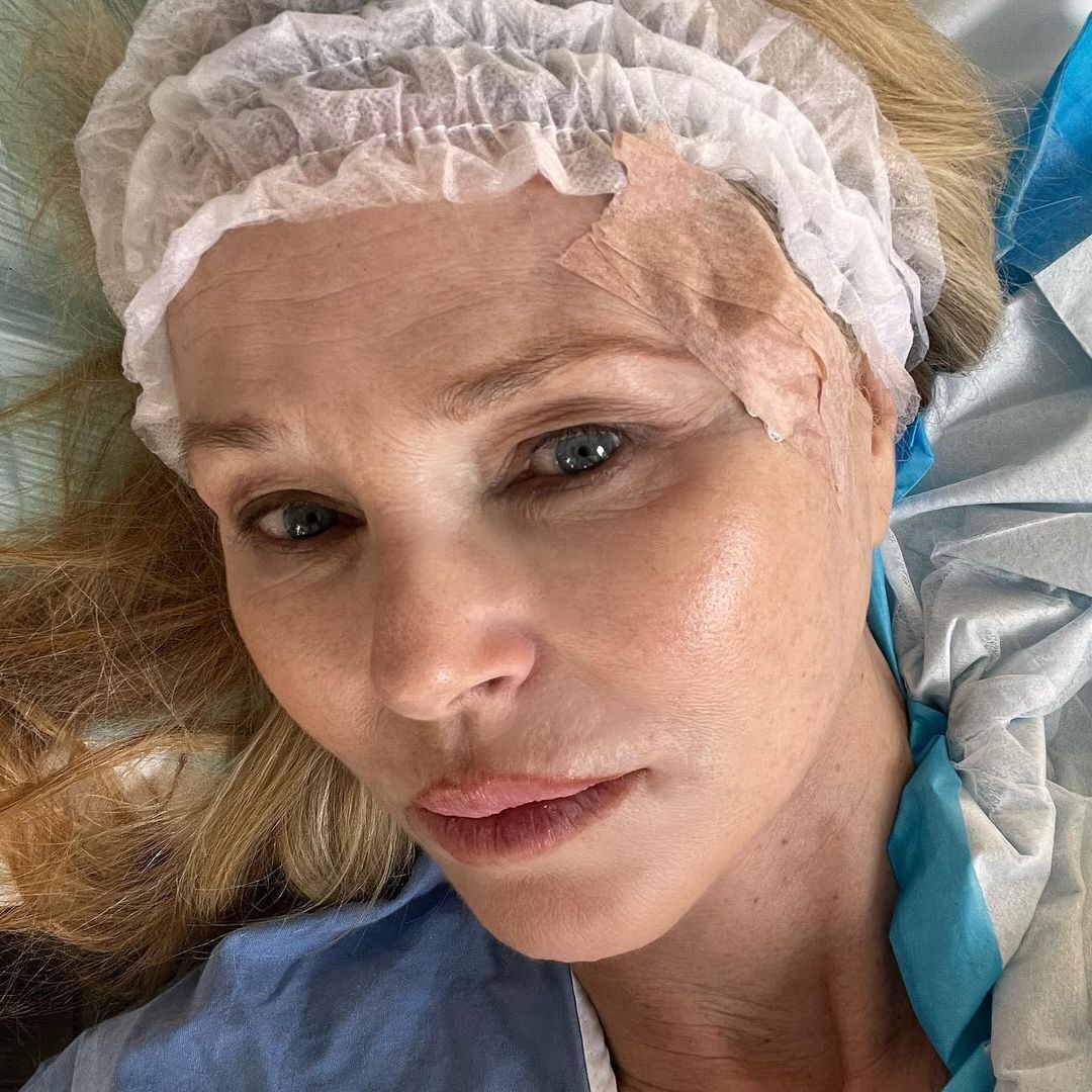 У Крісті Брінклі виявили рак шкіри: 70-річна супермодель показала перші фото після операції