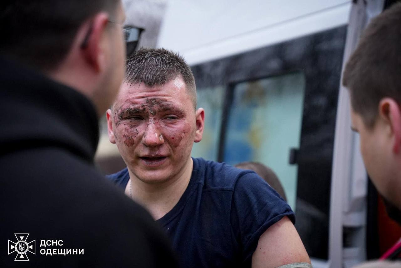 Оккупанты нанесли удар по Одессе, погибли 20 человек, десятки ранены: 16 марта объявлено днем траура. Фото