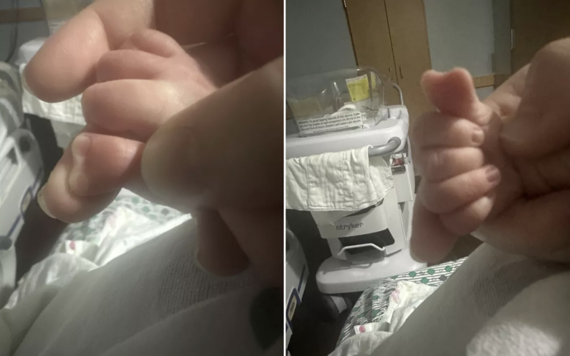 Лікарі ніколи такого не бачили: у США народився хлопчик з великим пальцем у формі серця. Фото
