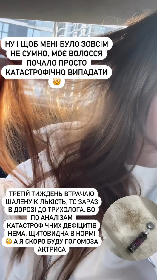 Екатерине Тишкевич стало хуже: вернулась сильная головная боль, выпадают волосы