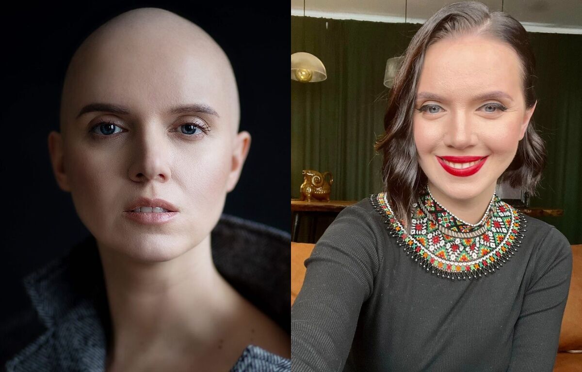Незламні духом: 5 історій українських знаменитостей, які перемогли рак