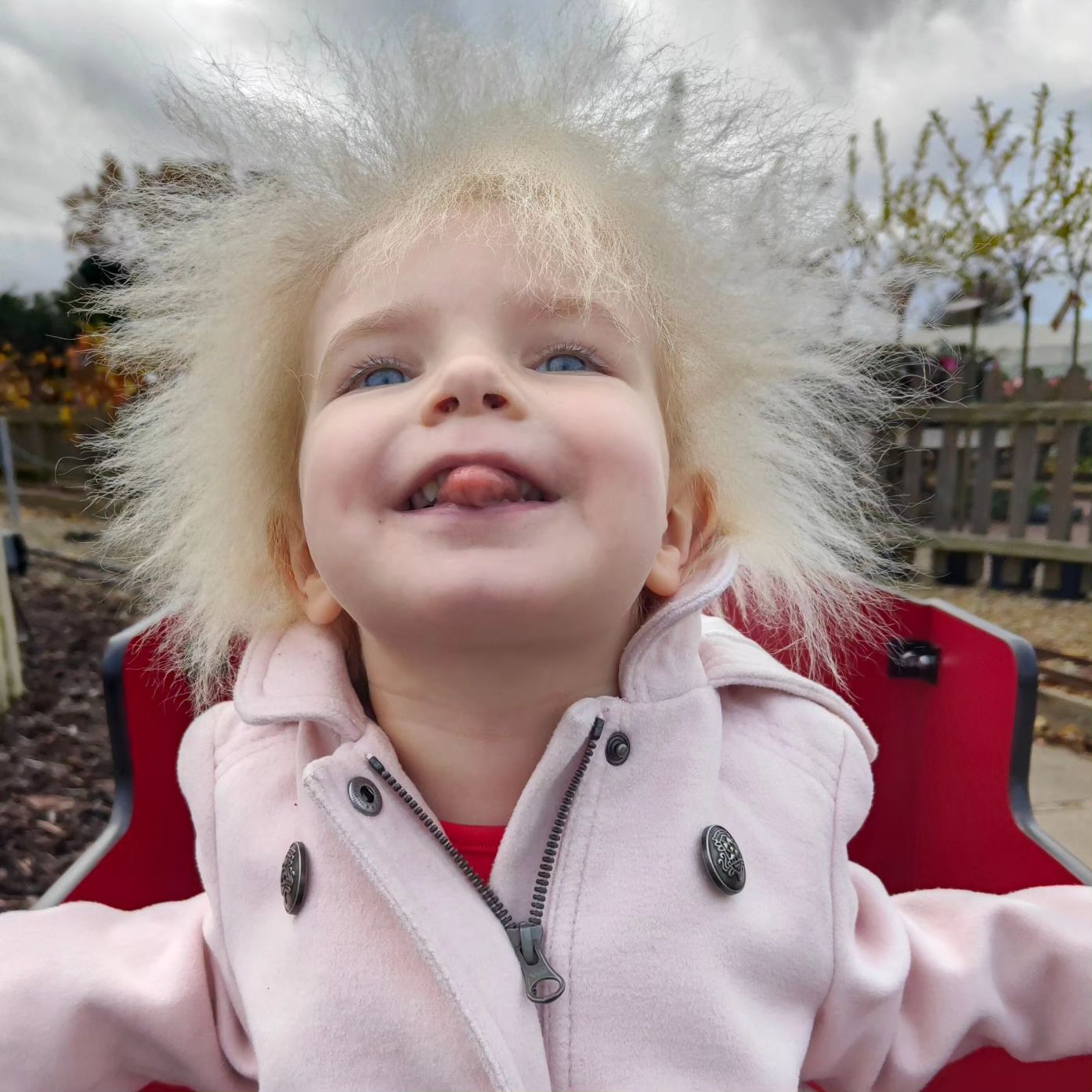 У трирічної дівчинки з Великої Британії діагностували синдром нерозчесаного волосся: таких людей лише 100 на весь світ. Фото