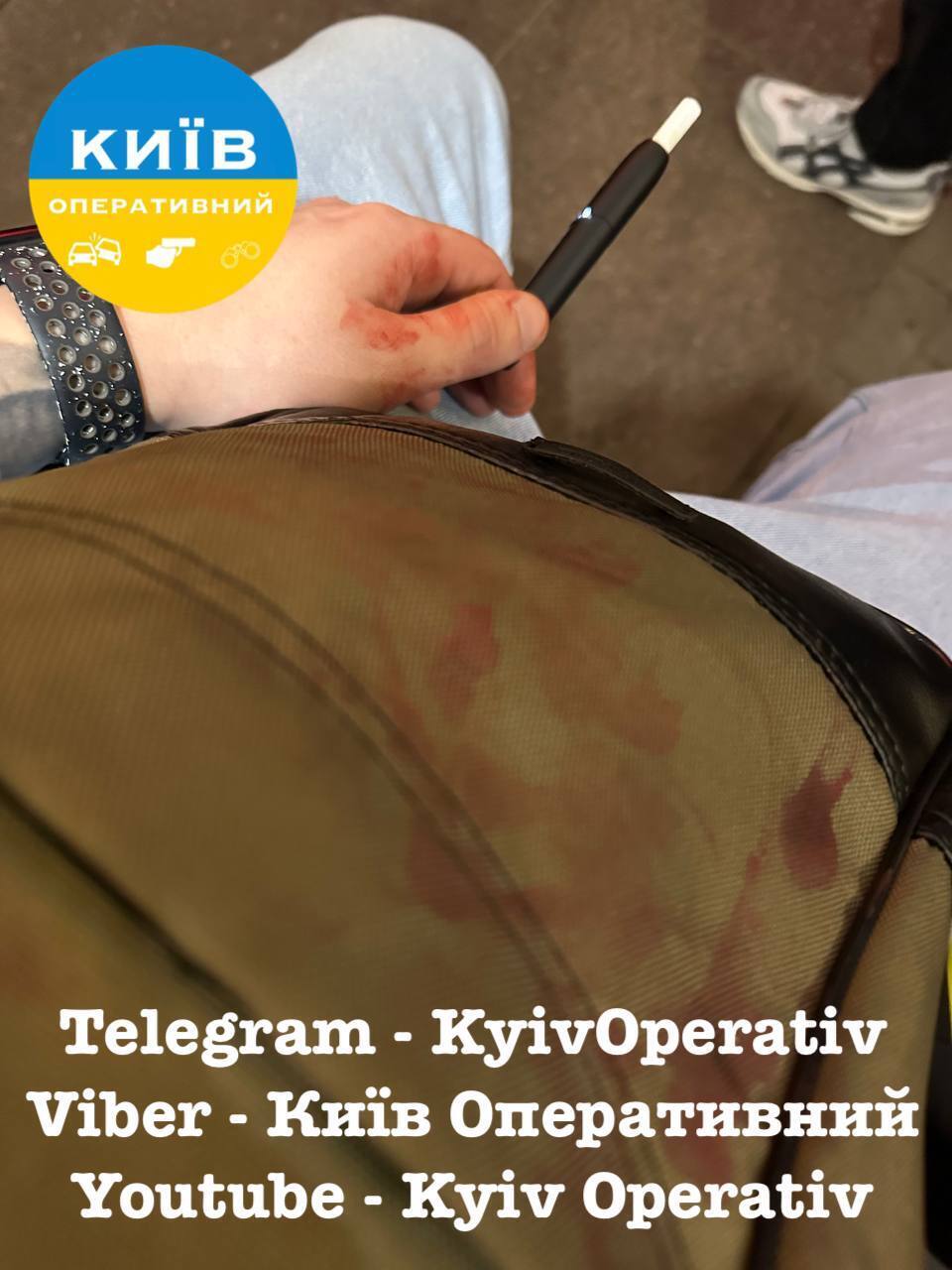 В Киеве мужчина разбил стекло фуникулера и порезал горло подростку: все детали, фото и видео 18+