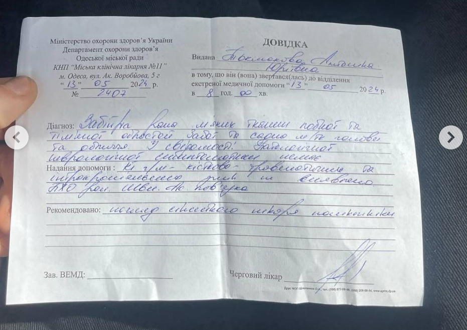 В Одесі дівчина заявила, що співробітник ТЦК побив її милицею: розпочато службову перевірку