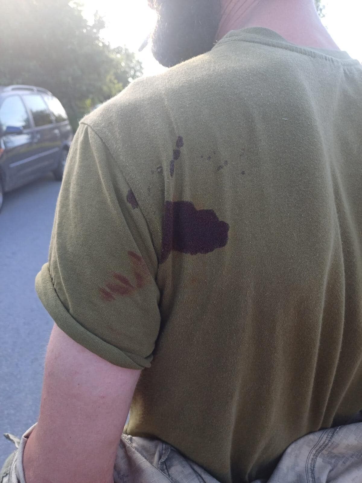 На Хмельниччині чоловік ударив ножем представника ТЦК: емоційна заява військового