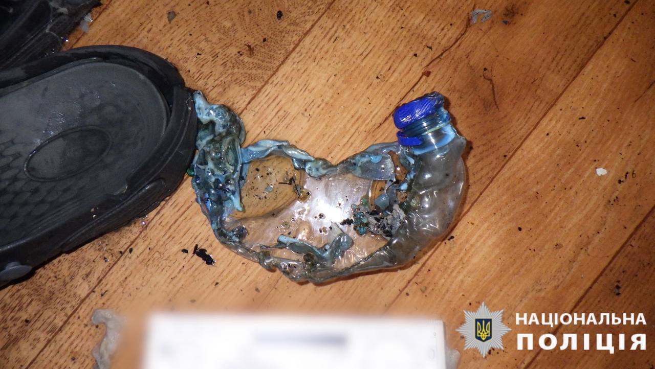 Вирішила помститись: на Київщині жінка облила сина легкозаймистою рідиною та підпалила