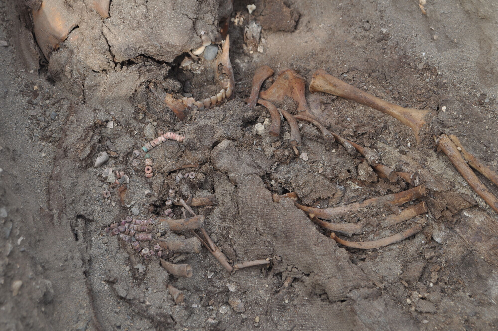 Скелеты детей помогли разгадать причину смерти 70% коренного населения инков в XVI веке. Фото