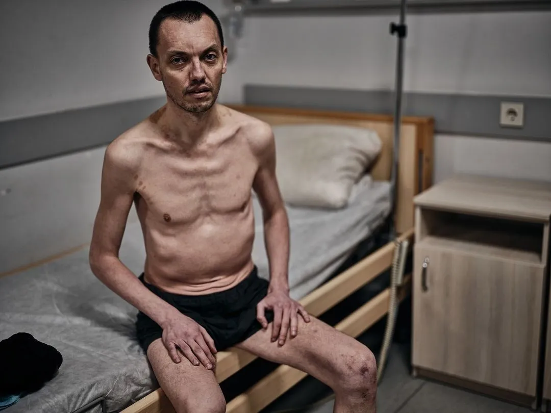 "Словно из концлагерей": сеть поразили фото, которые показали состояние освобожденных из российского плена украинцев
