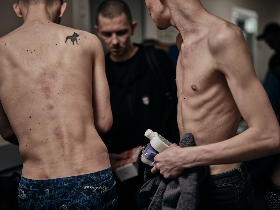 "Наче з концтаборів": мережу вразили фото, які показали стан звільнених з російського полону українців
