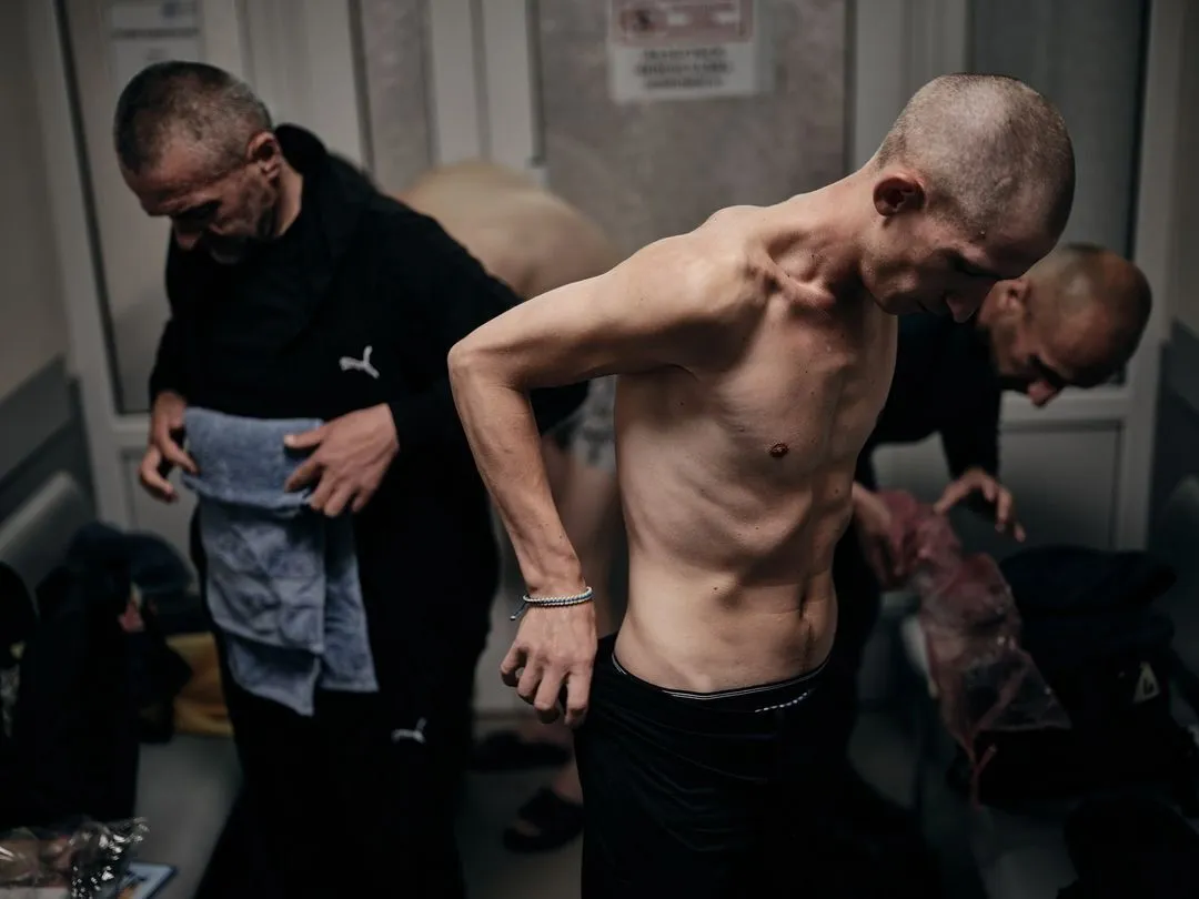 "Наче з концтаборів": мережу вразили фото, які показали стан звільнених з російського полону українців
