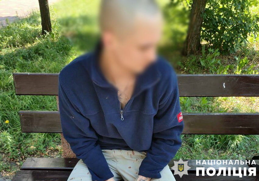 У Києві чоловік ледь не вбив ножицями перехожого: поліція розшукала нападника за кілька годин. Фото