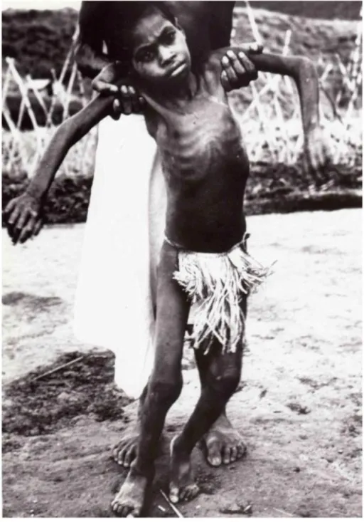 Він "дуже гіркий". Який орган тіла ніколи не їли канібали в Папуа – Новій Гвінеї