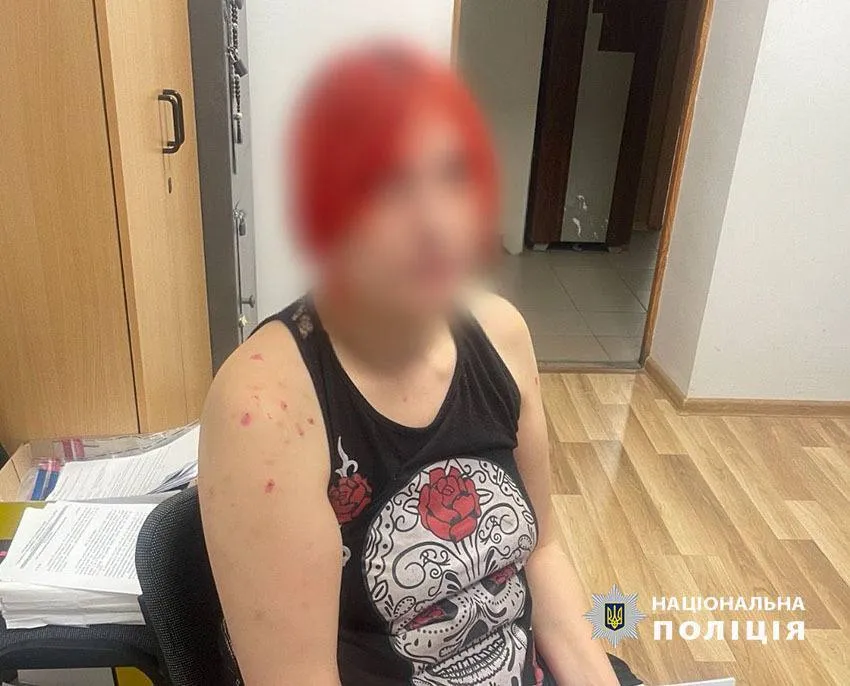 У Києві жінка під час конфлікту ледь не вбила нову кохану колишнього чоловіка. Подробиці і фото