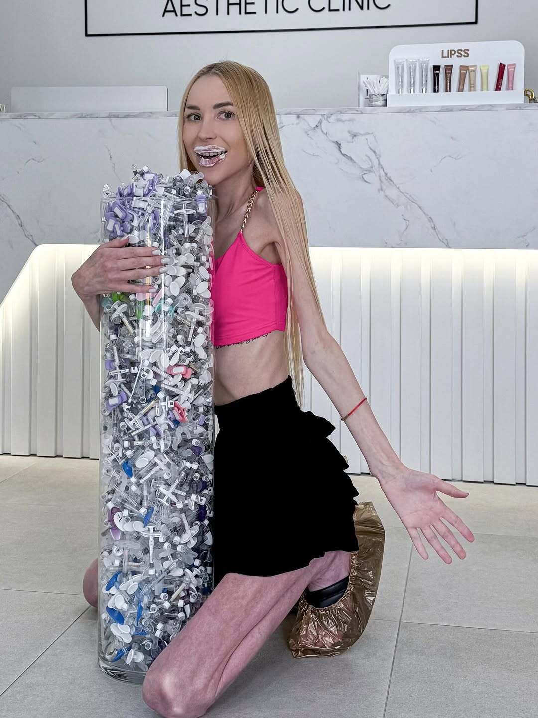 Важить 23 кг і мріє схуднути ще більше: що відомо про блогерку Аліну Ліпницьку, яку звинувачують в анорексії. Фото