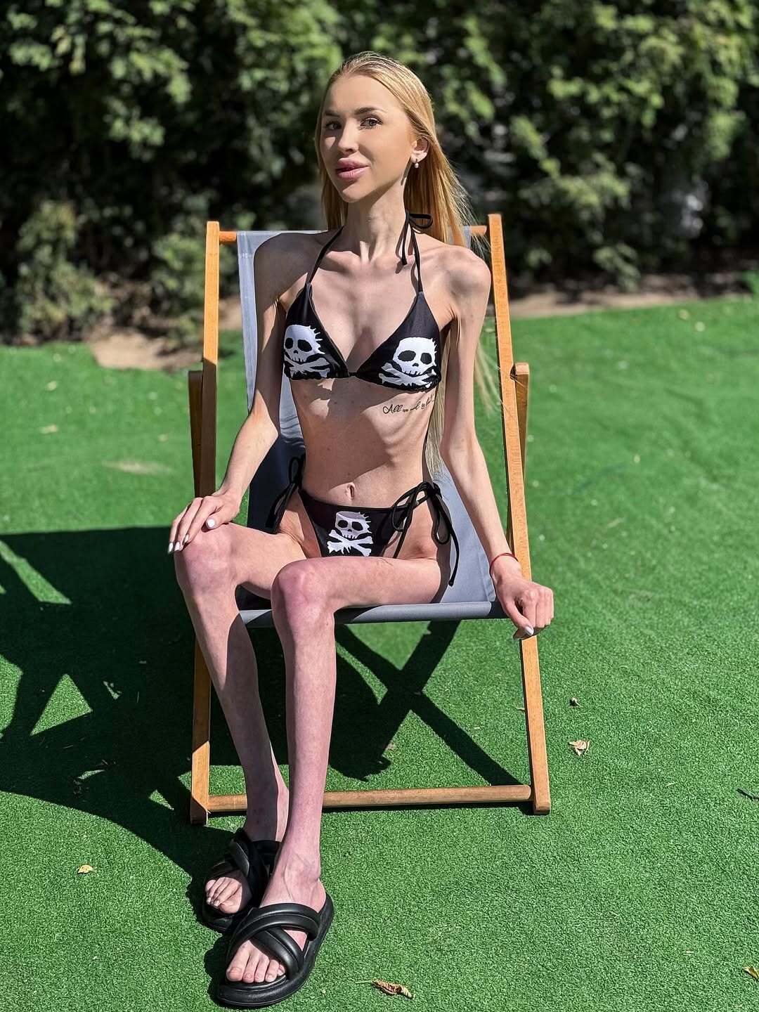 Важить 23 кг і мріє схуднути ще більше: що відомо про блогерку Аліну Ліпницьку, яку звинувачують в анорексії. Фото