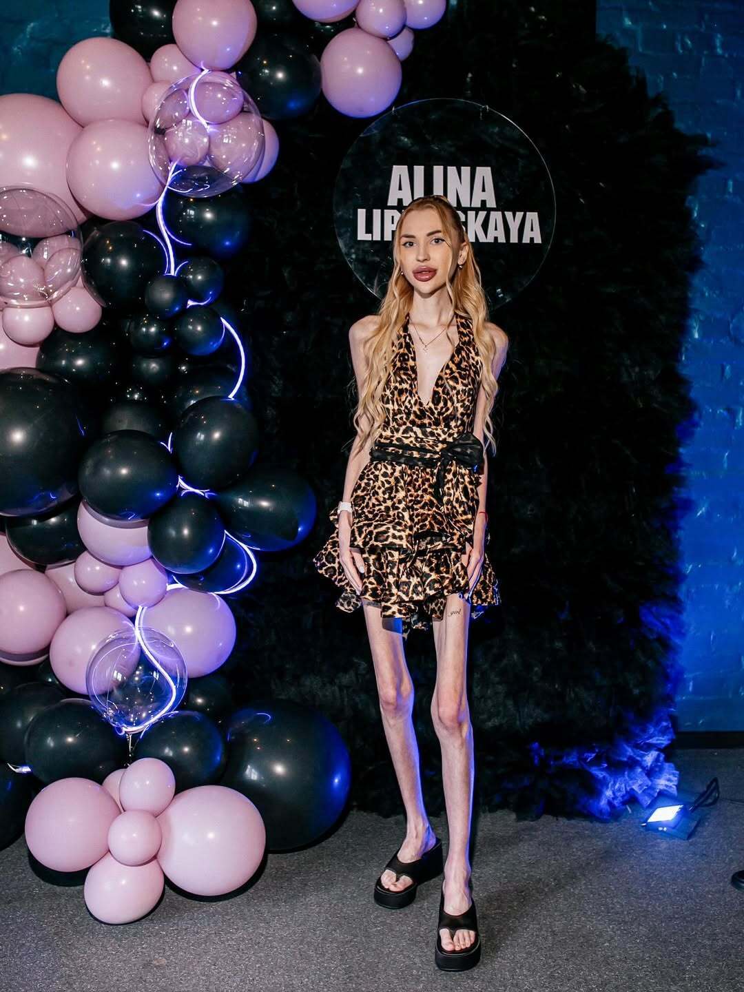 Важить 23 кг і мріє схуднути ще більше: що відомо про блогерку Аліну Ліпницьку, яку звинувачують в анорексії. Фото