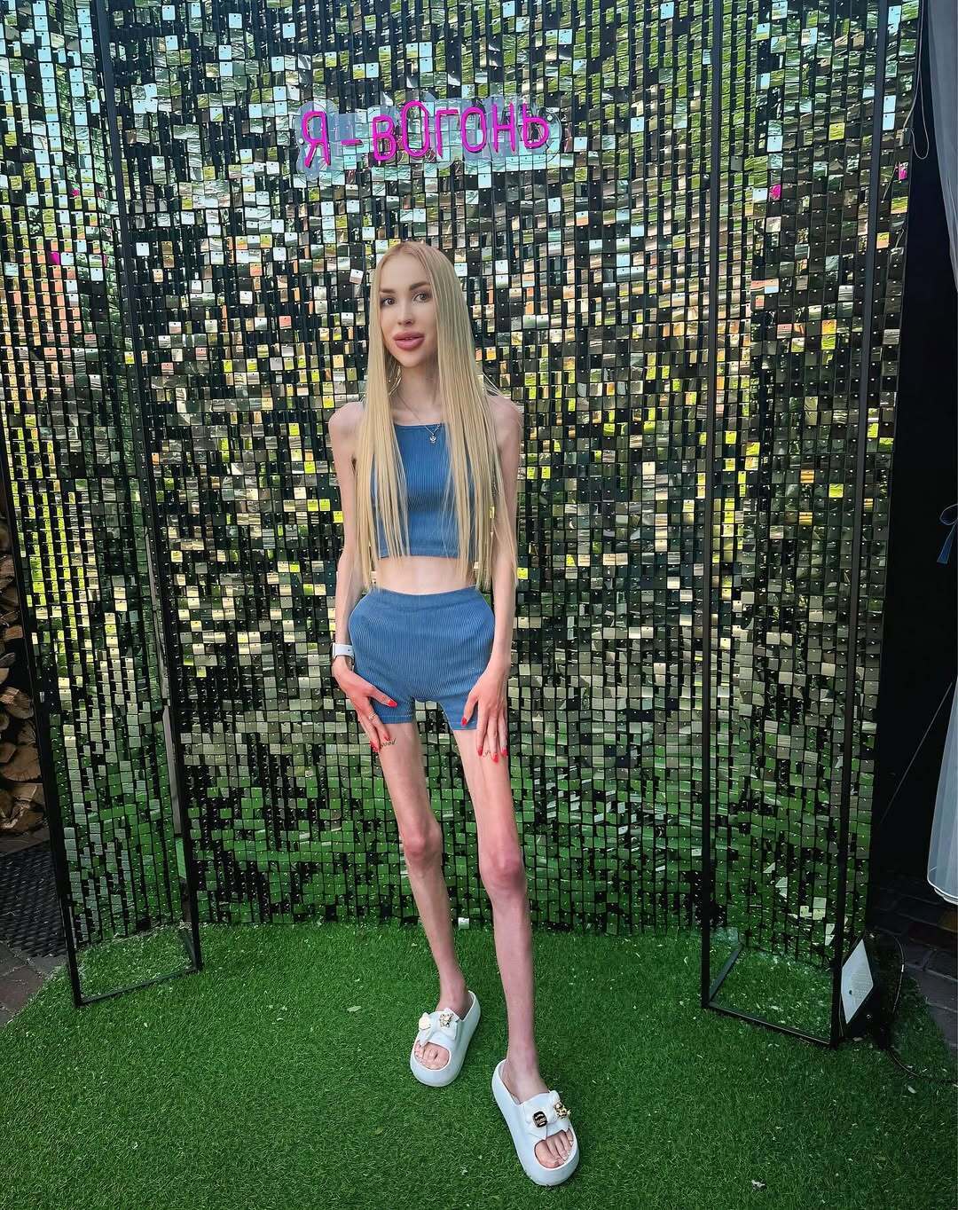 Важить 23 кг і мріє схуднути ще більше: що відомо про блогерку Аліну Ліпницьку, яку звинувачують в анорексії. Фото