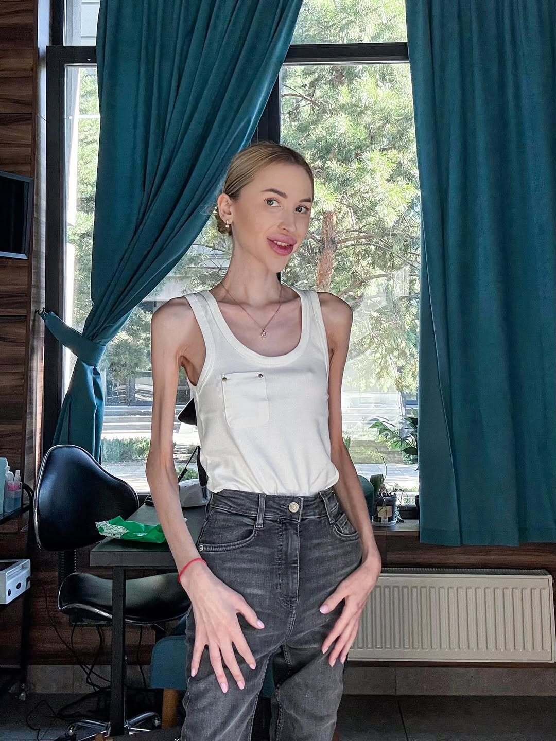 Важить 23 кг і мріє схуднути ще більше: що відомо про блогерку Аліну Ліпницьку, яку звинувачують в анорексії. Фото