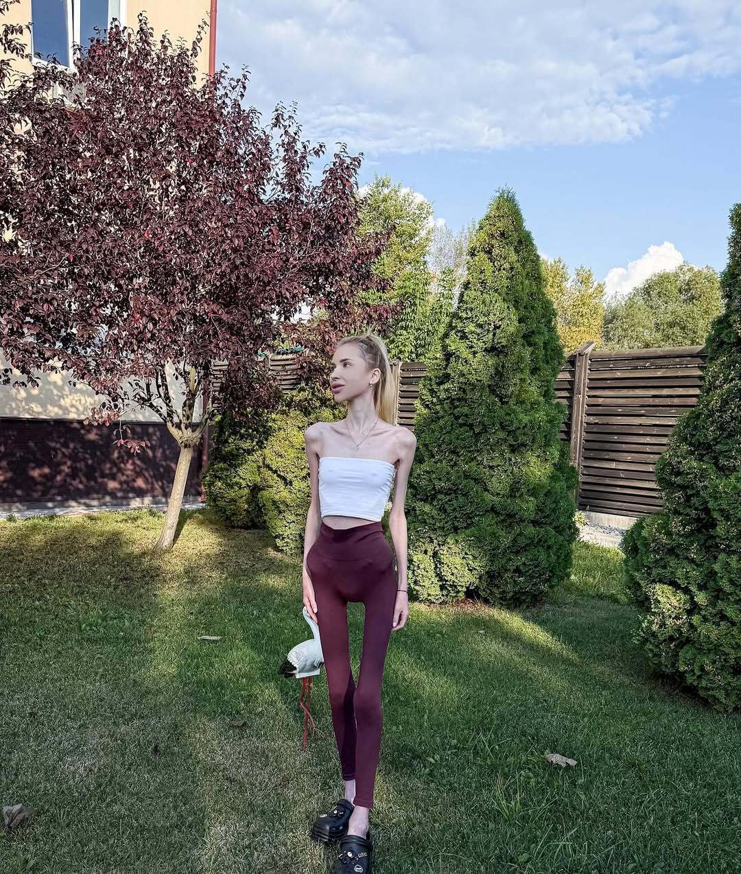 Важить 23 кг і мріє схуднути ще більше: що відомо про блогерку Аліну Ліпницьку, яку звинувачують в анорексії. Фото