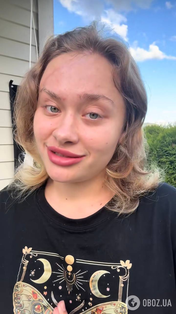 "Узнали?" Покалеченная в Дубае Мария Ковальчук вернулась в соцсети и показала, как живет через 7 месяцев после трагедии