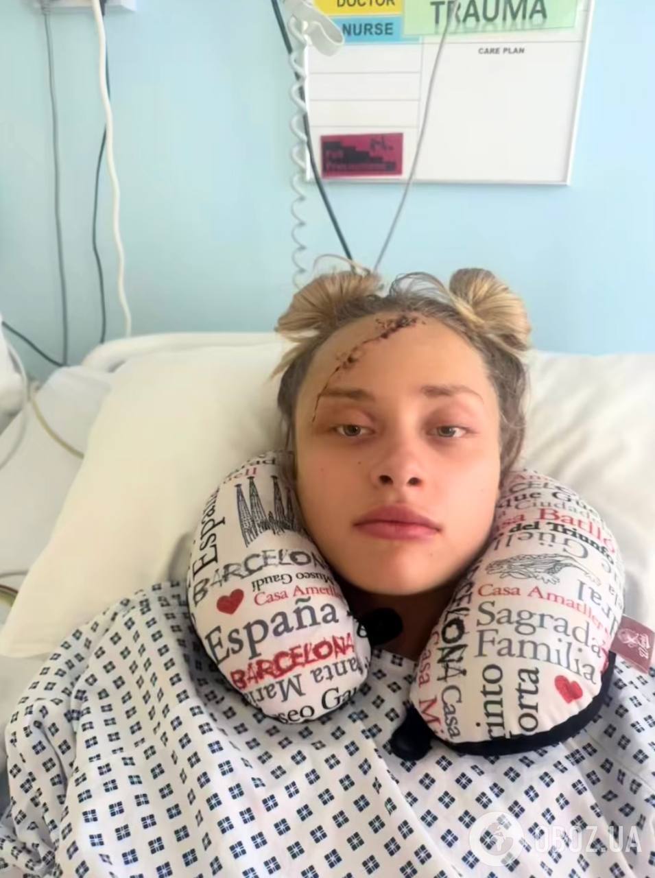 "Узнали?" Покалеченная в Дубае Мария Ковальчук вернулась в соцсети и показала, как живет через 7 месяцев после трагедии