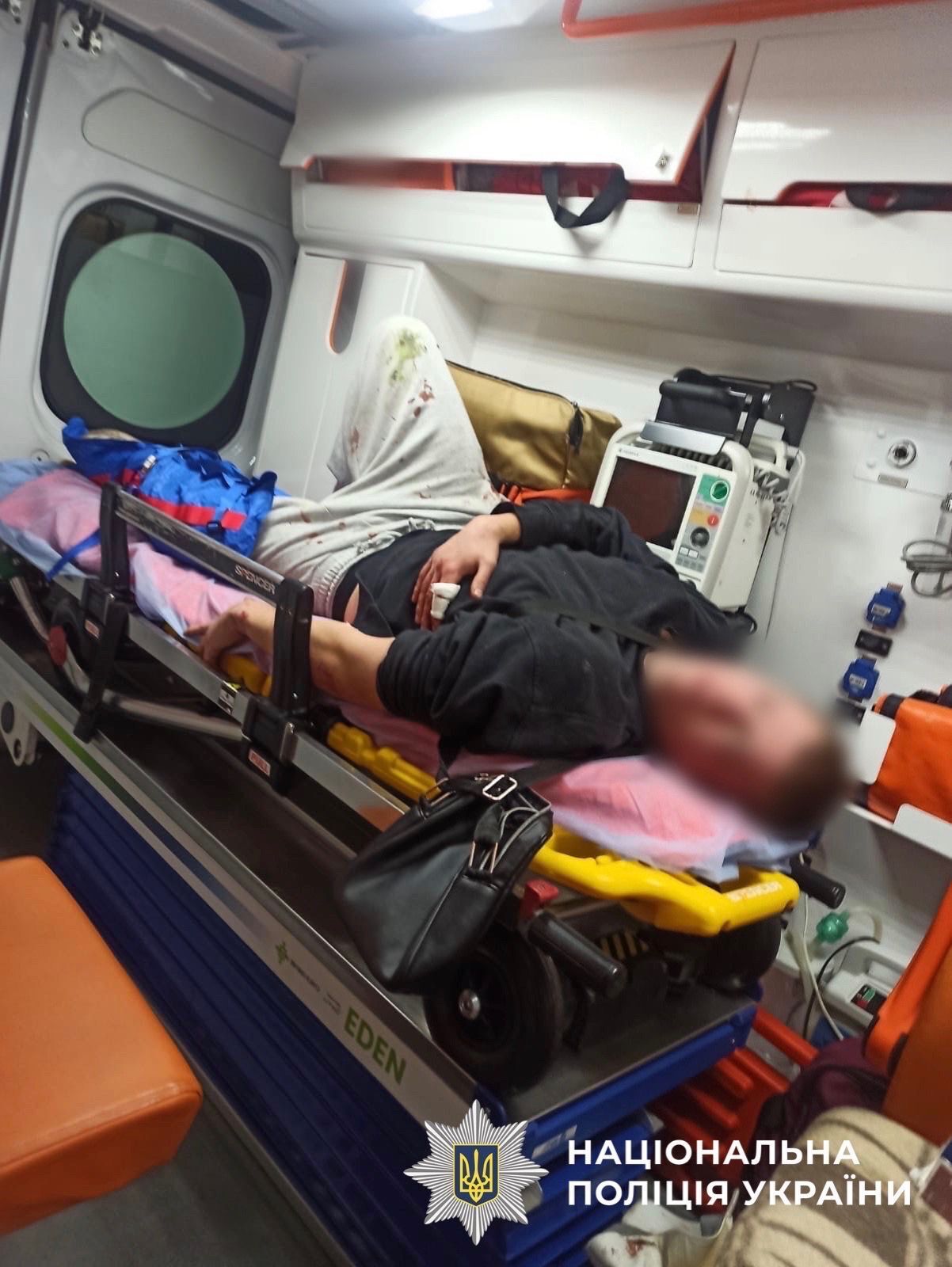 В Киеве молодой человек ранил ножом прохожего за отказ дать сигарету: убегая, нападавший сломал ногу. Фото