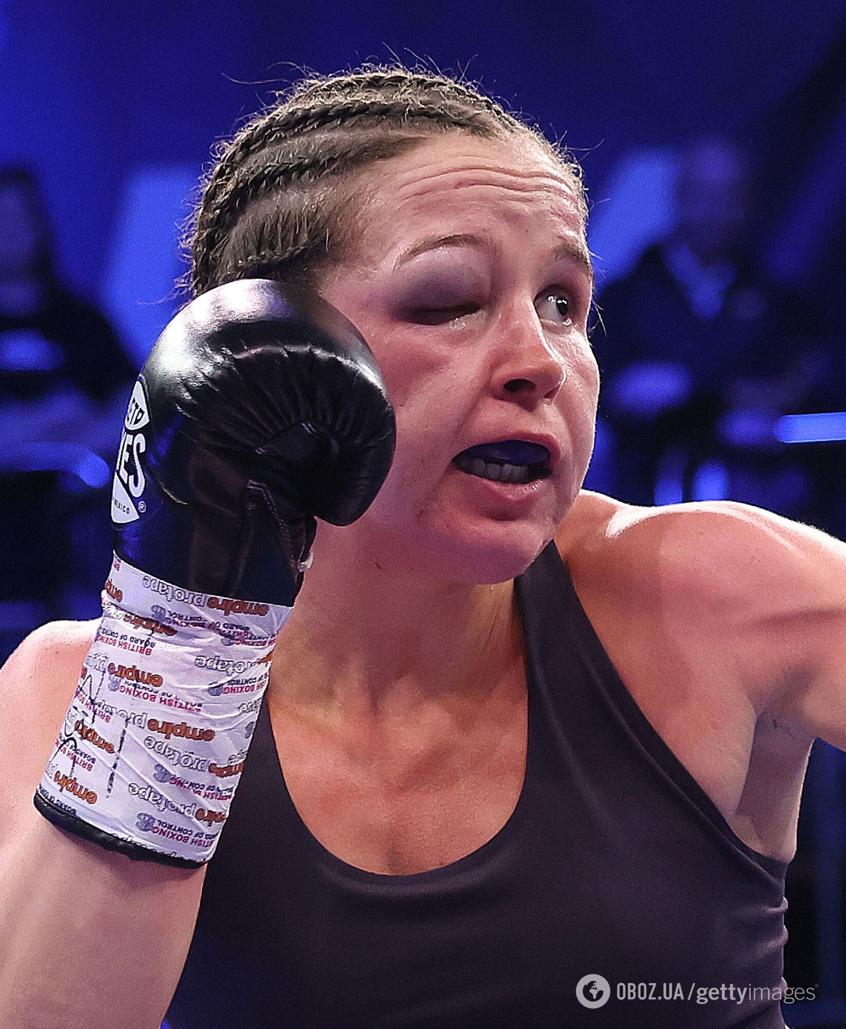 Боксерка перетворилася до невпізнання через страшну гематому, отриману в бою. Фото і відео