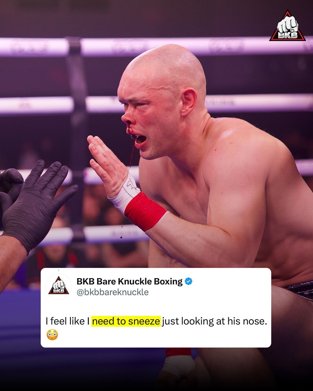 Бойцу во время поединка на голых кулаках впечатали нос в лицо. Видео собрало 1 млн просмотров