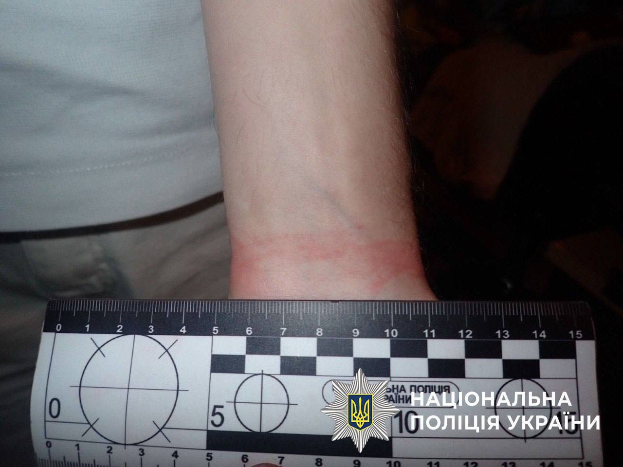 У Києві троє молодиків жорстоко побили та пограбували чоловіка: знайшли через онлайн-знайомства. Подробиці та фото