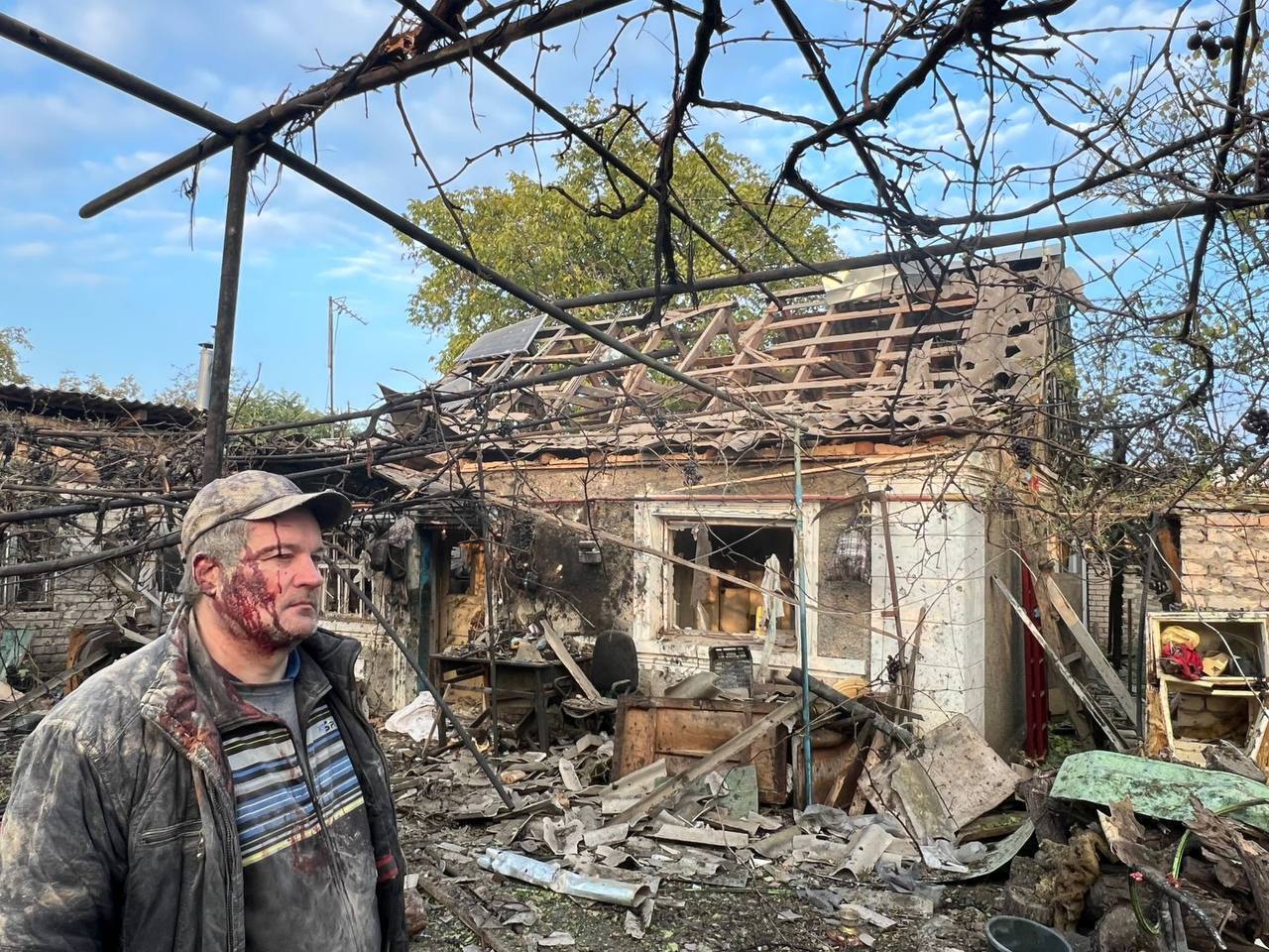 Окупанти атакували Херсон: є влучання в багатоповерхівку та маршрутку, загиблі і багато постраждалих. Фото та відео