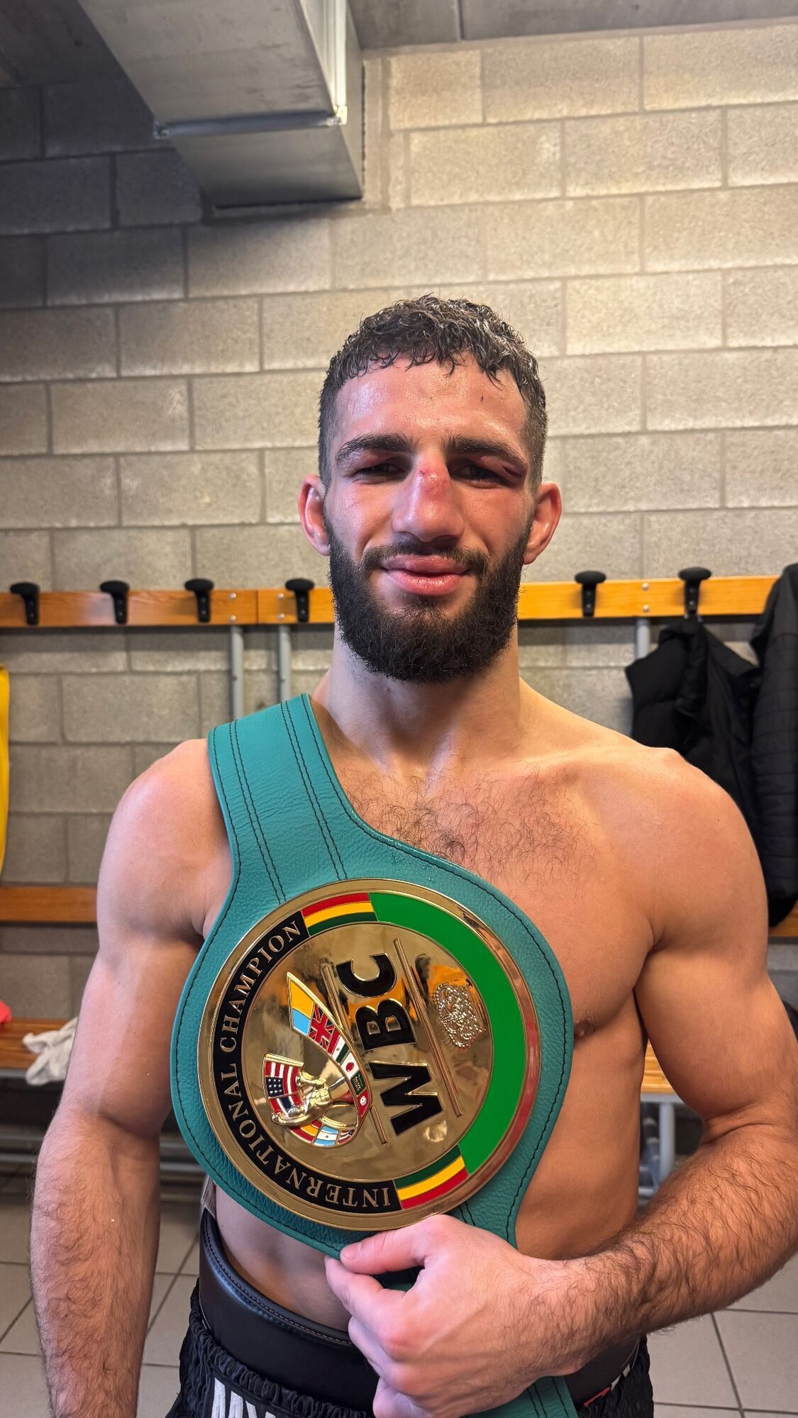 Непереможний український боксер у бою з двома брутальними нокдаунами здобув чемпіонський пояс. Відео