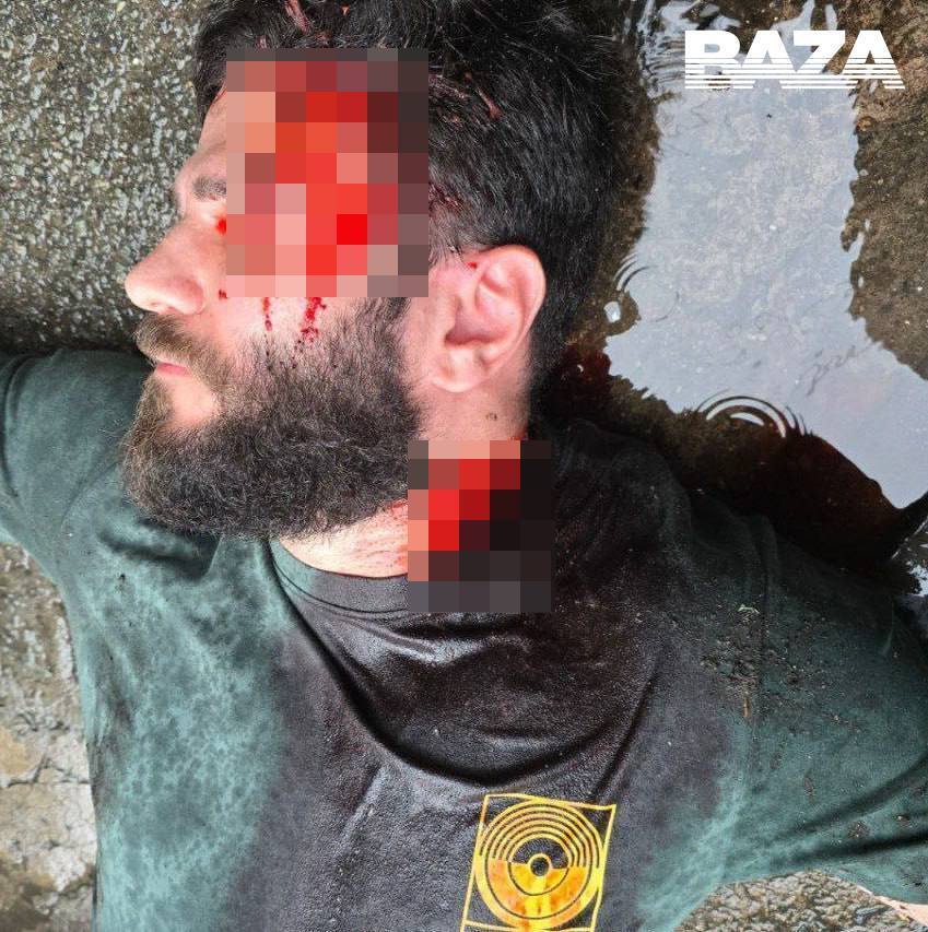 В сети распространяются фото "убитого" российского пропагандиста: подозревают постановку. Фото 18+