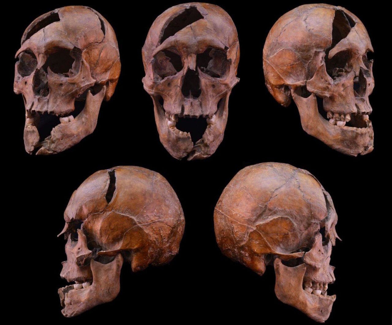 Завдали 26 ударів: вбитий у XIII столітті чоловік виявився сином галицького князя. Фото