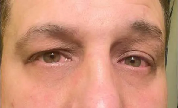 Обізвали "тиловим щуром" і задули перцевим балоном: в Одесі працівник ТЦК, поліцейський і учасники "ГО" скоїли напад на захисника