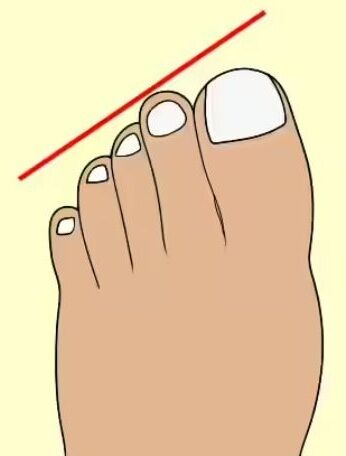 У вас египетская, греческая или римская стопа? Тест на личность