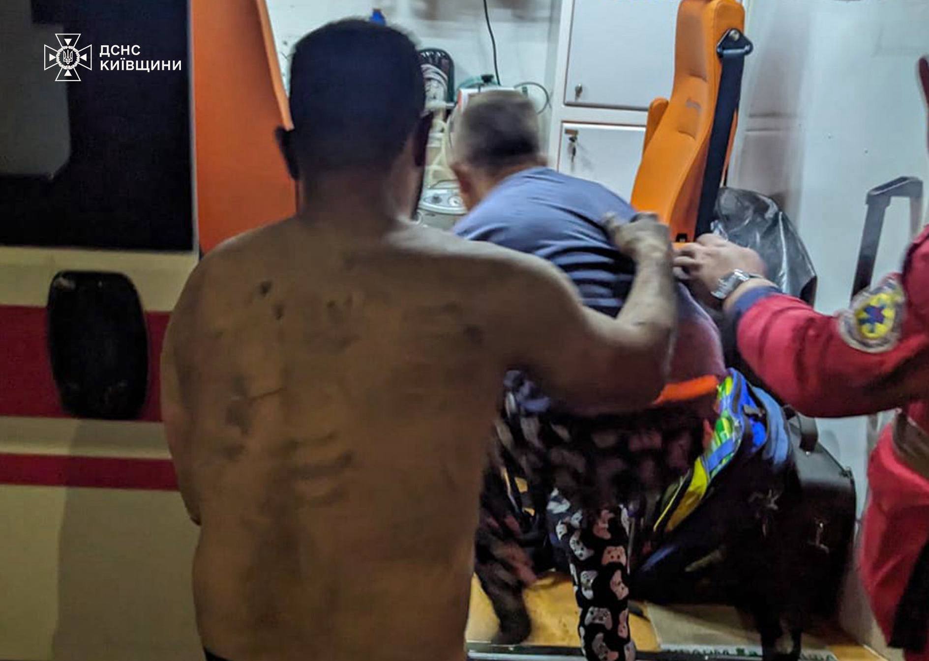 На Київщині вибух зарядного пристрою ледь не забрав життя родини з двома дітьми. Подробиці та фото