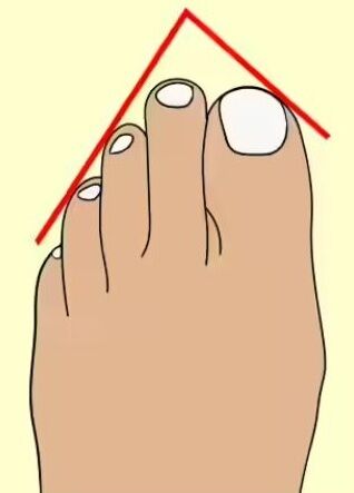 У вас египетская, греческая или римская стопа? Тест на личность