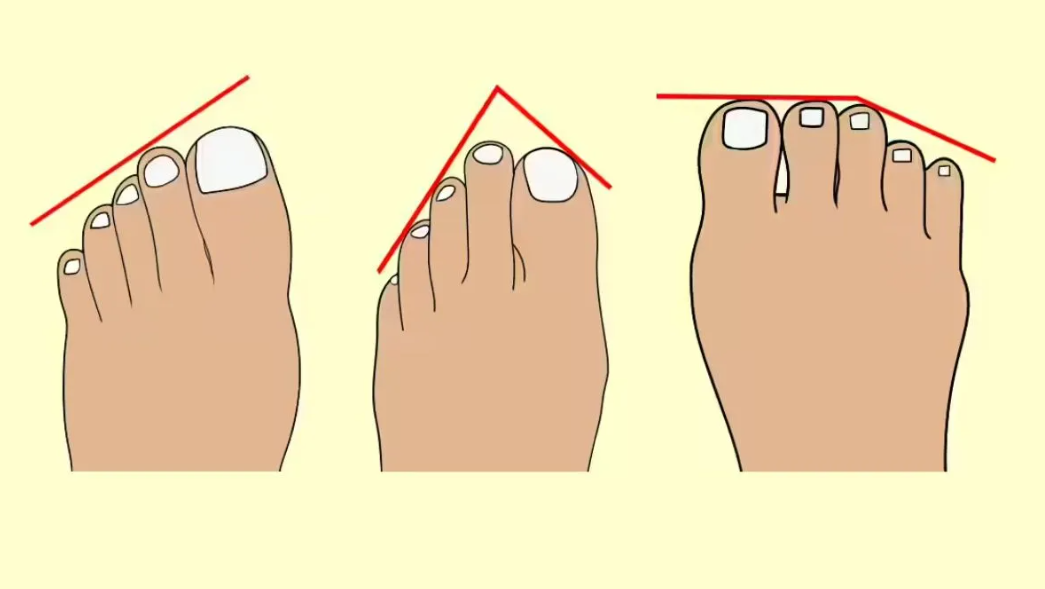 У вас египетская, греческая или римская стопа? Тест на личность