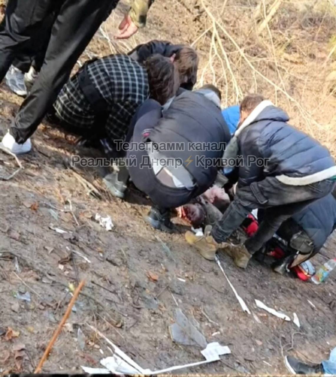 В Днепре в результате российской атаки пострадали два человека: женщине оторвало ногу, ребенку осколок попал в лицо