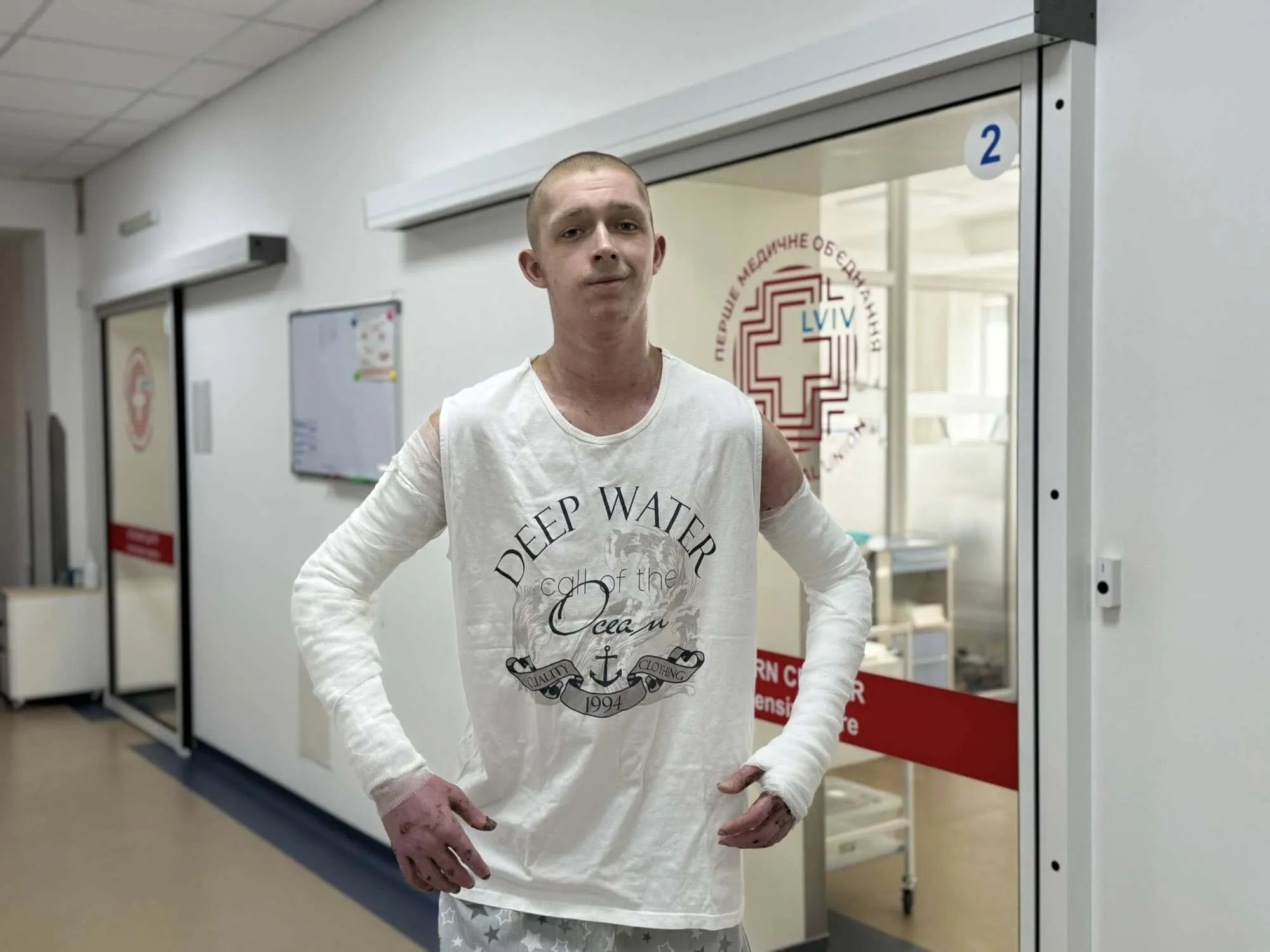 "Міг загинути": у Львові медики врятували 19-річного хлопця, який отримав опіки 60% тіла, коли фарбував дах. Фото