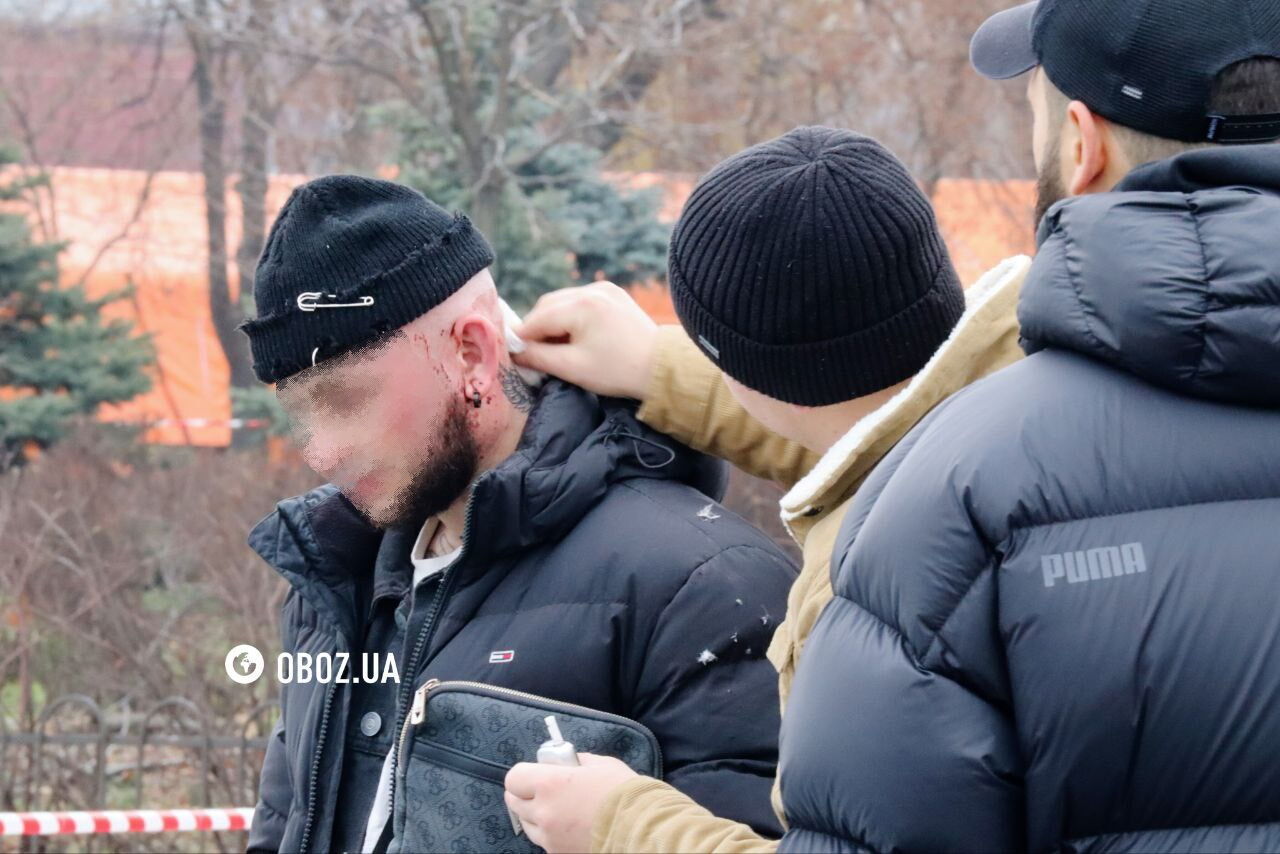 Российская ракета убила прохожего в Киеве, есть раненые: эксклюзивные фото и видео с места