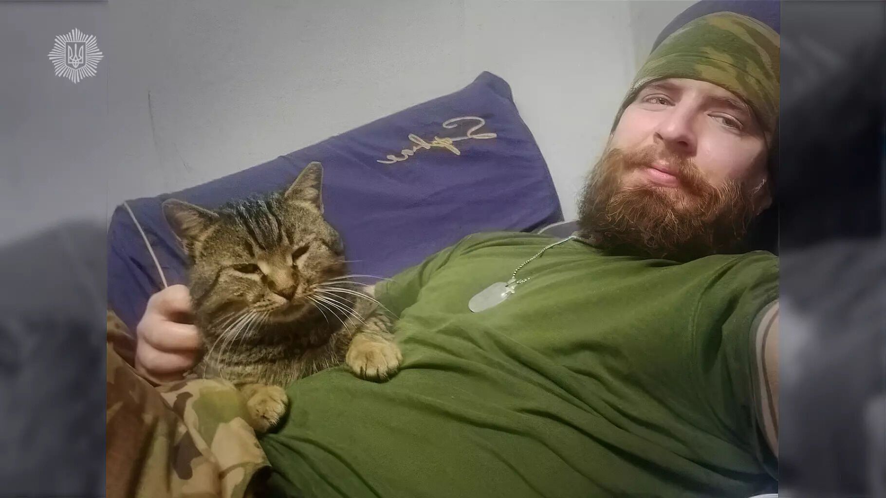 Украинский защитник перенес ампутацию ног, 25 операций и снялся в фильме: история настоящего героя