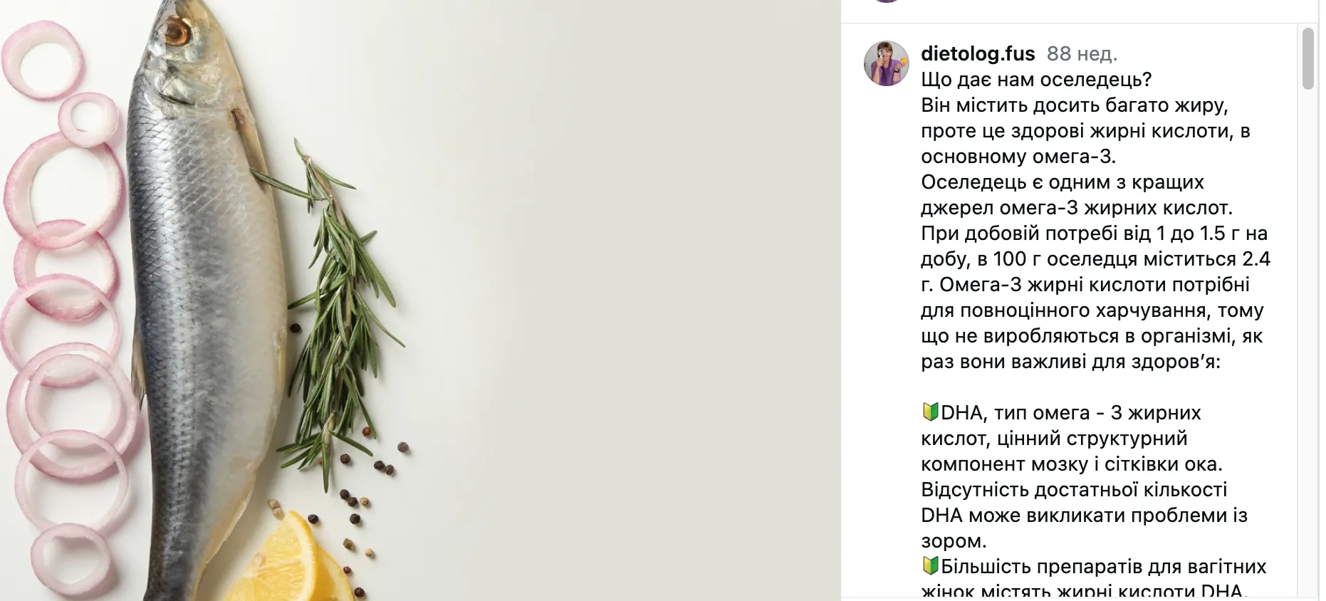 Почему нужно обязательно добавить сельдь в свой рацион и как часто есть продукт: советы от Светланы Фус