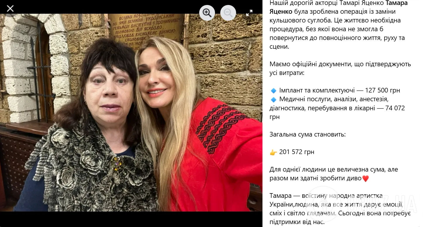 Народна артистка України перенесла операцію та приголомшила мережу витраченою сумою