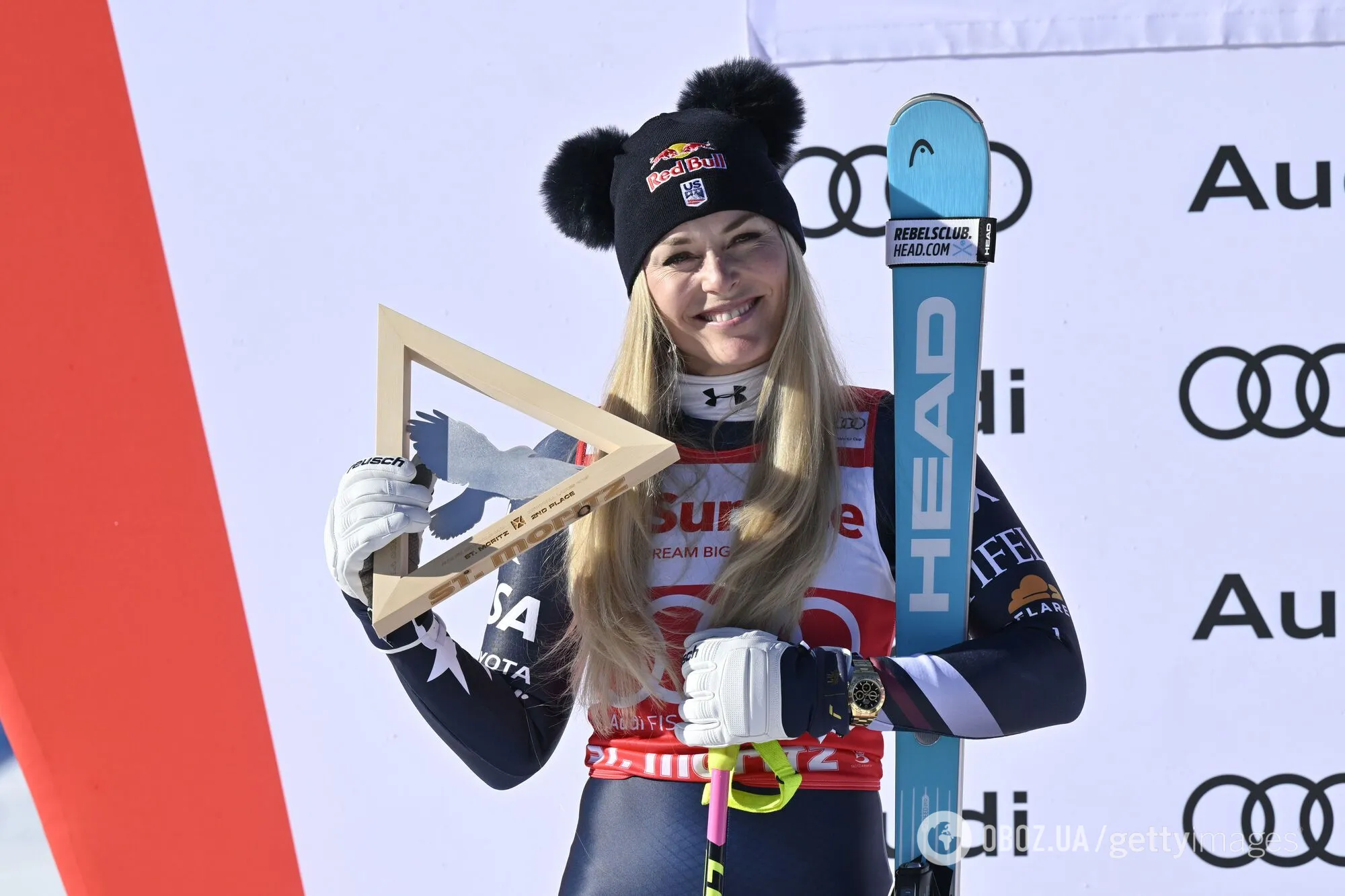 Як змінилась найкрасивіша спортсменка Олімпіади-2010, яка у 41 перемагає на Кубку світу: чемпіонка кинула мільйонера, вечеряла з Кличком і замінила коліно