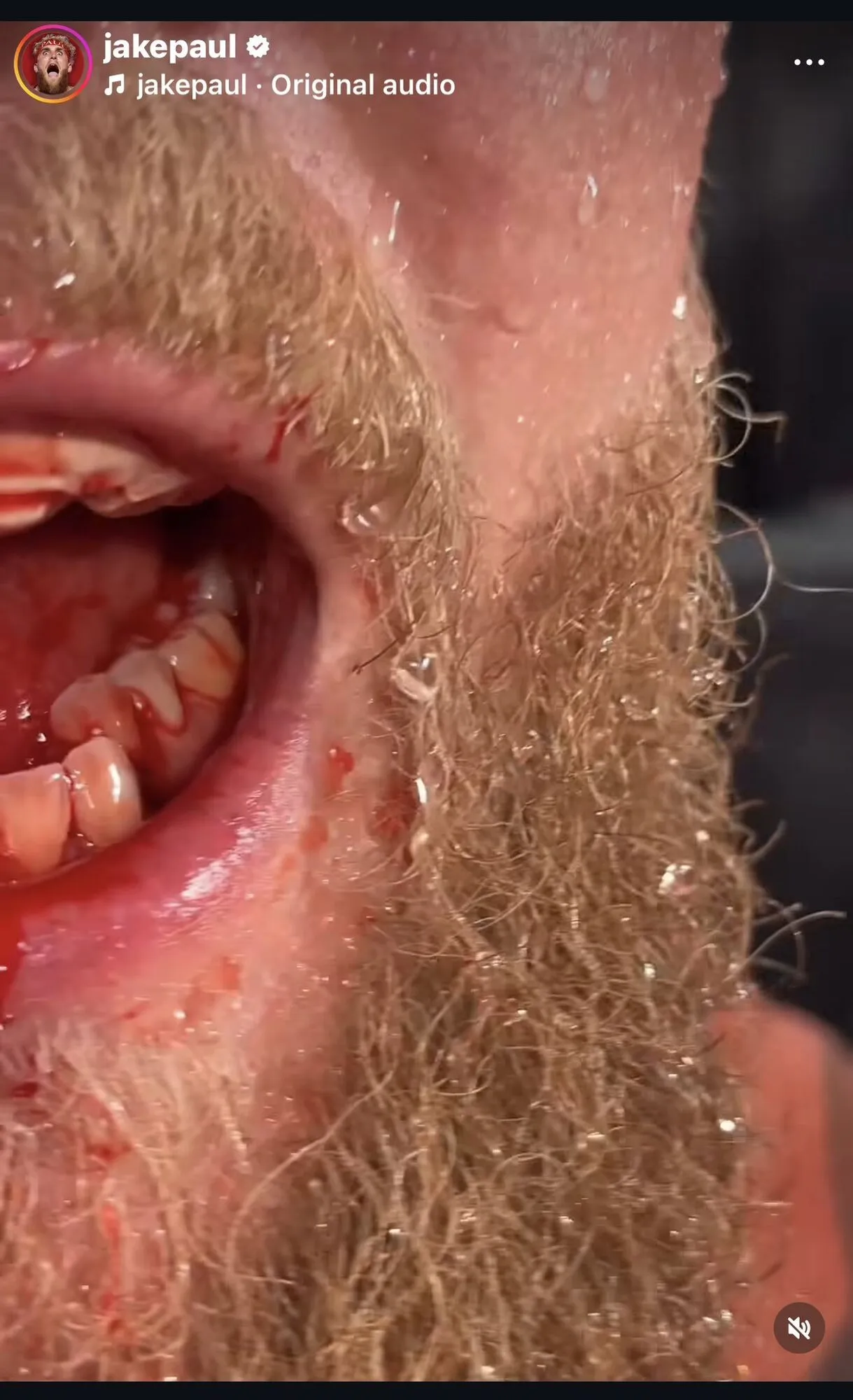 Три нокдауна и перелом челюсти! Бой Пол – Джошуа завершился нокаутом в шестом раунде. Видео