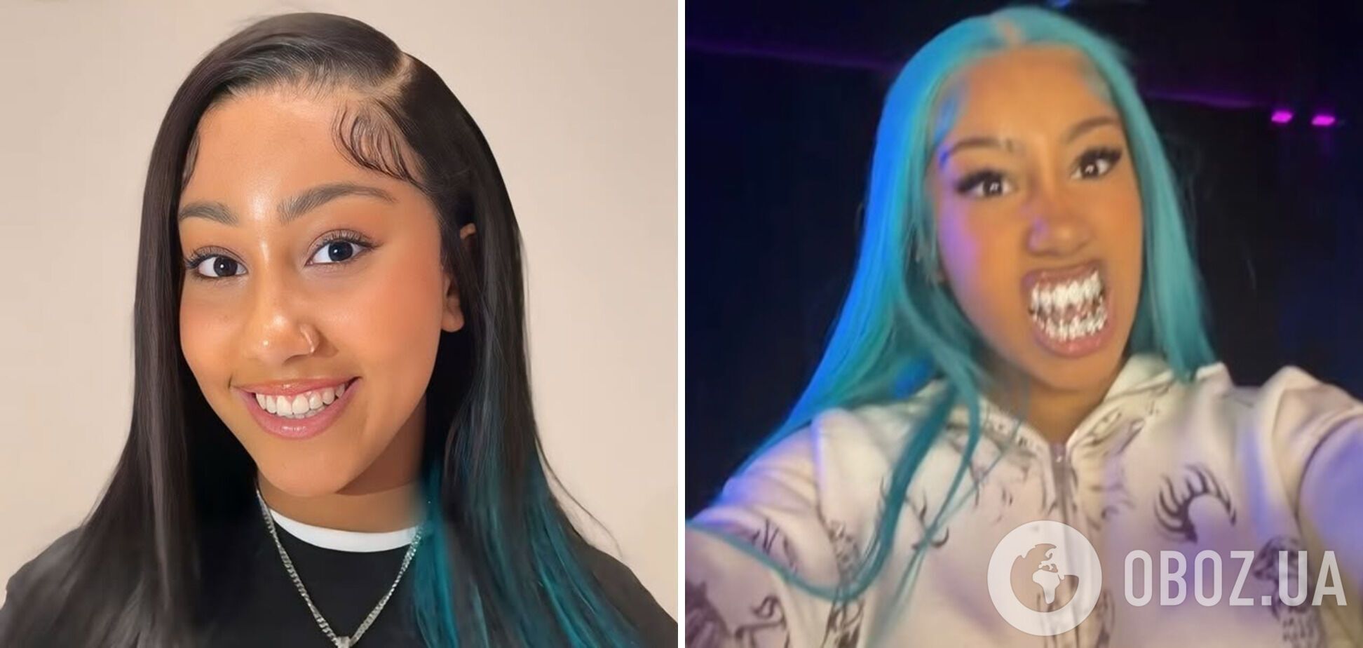 12-летняя дочь Ким Кардашьян вставила бриллиантовые "зубы акулы" и нарвалась на критику. Эпатажные фото