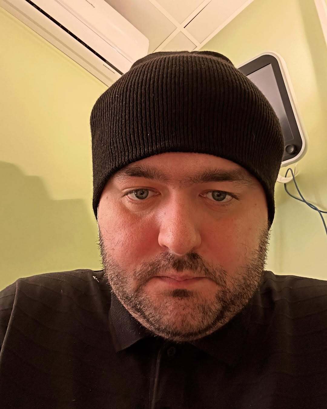 Терял сознание, были судороги: звезда "Лиги смеха" перенес сложную операцию из-за кровоизлияния в мозг